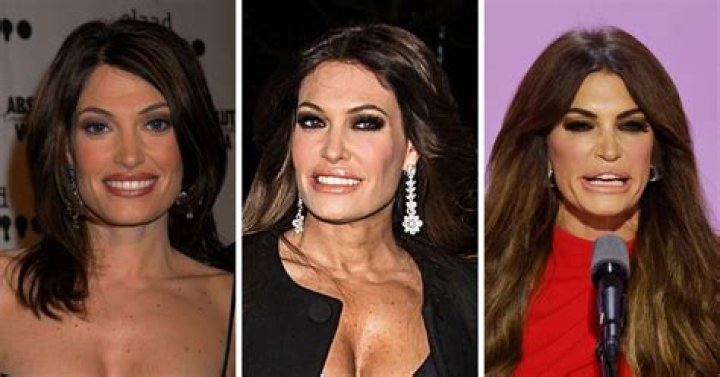 Unveiling The Changes: What Has Kimberly Guilfoyle Done To Her Face?